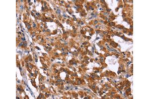 Immunohistochemistry (IHC) image for anti-HECT Domain and Ankyrin Repeat Containing, E3 Ubiquitin Protein Ligase 1 (HACE1) antibody (ABIN2434736)