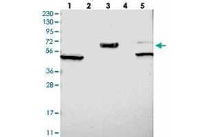 Western blot analysis of Lane 1: RT-4, Lane 2: U-251 MG, Lane 3: Human Plasma, Lane 4: Liver, Lane 5: Tonsil with WSCD2 polyclonal antibody . (WSCD2 anticorps)