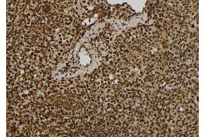 ABIN6279422 at 1/100 staining Mouse spleen tissue by IHC-P. (EIF3A anticorps  (C-Term))