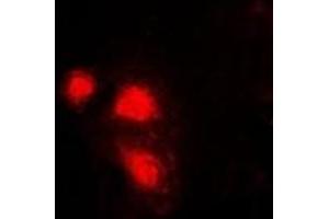 Immunofluorescent analysis of eIF3E staining in Hela cells.