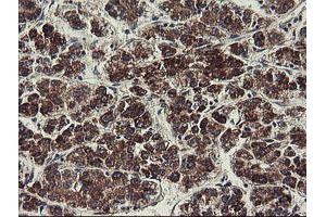 Image no. 17 for anti-Ubiquitin-Conjugating Enzyme E2, J1, U (UBE2J1) antibody (ABIN1501637)