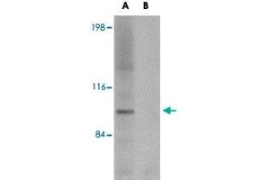 Western blot analysis of NLRP3 in K-562 cell lysate with NLRP3 polyclonal antibody  at 1 ug/mL (A) in the absence and (B) in the presence of blocking peptide. (NLRP3 anticorps  (AA 120-170))