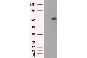 Image no. 2 for anti-Glucose-6-Phosphate Isomerase (GPI) antibody (ABIN1498505)