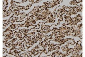 ABIN6272867 at 1/100 staining Human lung tissue by IHC-P.