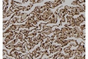 ABIN6272867 at 1/100 staining Human lung tissue by IHC-P. (TPI1 anticorps  (C-Term))