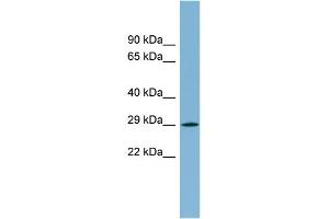 WB Suggested Anti-MPZL2 Antibody Titration:  0. (MPZL2 anticorps  (N-Term))