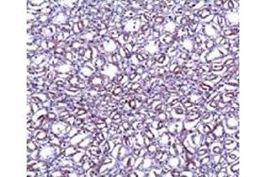 Immunohistochemical staining of formalin-fixed paraffin-embedded human renal tissue showing staining with ANGPT2 polyclonal antibody  at 1:100 dilution.