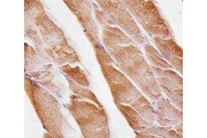 Immunohistochemical analysis of paraffin-embedded mouse skeletal muscle using Musk antibody at 1:25 dilution. (MUSK anticorps)