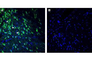 Expression of SEZ6 in mouse substantia nigra pars compacta (SNC). (SEZ6 anticorps  (Extracellular))