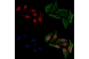 ABIN6254899 and ABIN6267063 staining HepG2 cells(30 min of 4uM Forskolin treatment) by IF/ICC. (Histone H4 anticorps  (H4K12ac))