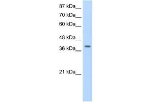 WB Suggested Anti-LAntibody Titration:  1. (LARP7 anticorps  (C-Term))
