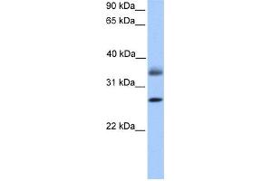 WB Suggested Anti-LGALS8 Antibody Titration: 0. (LGALS8 anticorps  (C-Term))