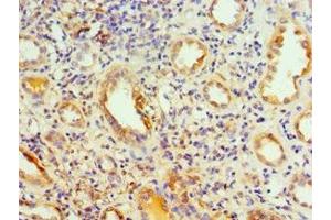 Immunohistochemistry of paraffin-embedded human kidney tissue using ABIN7142036 at dilution of 1:100 (PIKFYVE anticorps  (AA 1819-2098))