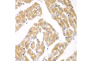 Immunohistochemistry of paraffin-embedded mouse heart using TOMM20 antibody (ABIN5974102) at dilution of 1/100 (40x lens). (TOMM20 anticorps)