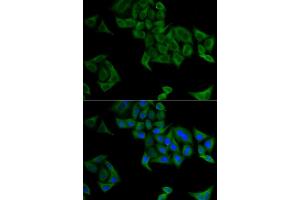 Immunofluorescence analysis of A549 cells using SMYD5 antibody (ABIN5973641). (SMYD5 anticorps)