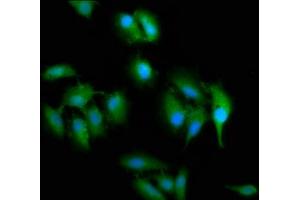 Immunofluorescence staining of Hela cells with ABIN7169791 at 1:200, counter-stained with DAPI. (SLC2A4RG anticorps  (AA 1-100))