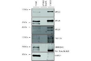 Immunoprecipitation analysis using Mouse Anti-VPS35 Monoclonal Antibody, Clone 11H10 (ABIN6933025).
