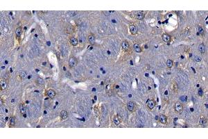 Detection of TIRAP in Mouse Cerebrum Tissue using Polyclonal Antibody to Toll Interleukin 1 Receptor Domain Containing Adaptor Protein (TIRAP)