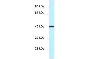 WB Suggested Anti-P2rx2 Antibody   Titration: 1. (P2RX2 anticorps  (Middle Region))