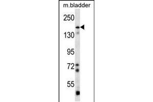 Western blot analysis in mouse bladder tissue lysates (35ug/lane). (BAI1 anticorps  (C-Term))