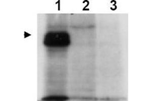 Image no. 1 for anti-MLF1 Interacting Protein (MLF1IP) (Thr78) antibody (ABIN401336) (MLF1IP anticorps  (Thr78))