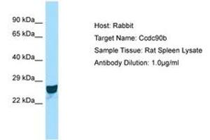 Image no. 1 for anti-Coiled-Coil Domain Containing 90B (CCDC90B) (AA 151-200) antibody (ABIN6749915) (CCDC90B anticorps  (AA 151-200))
