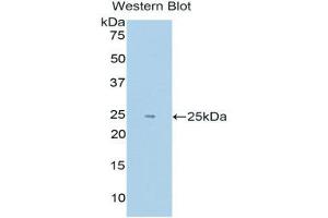 Western Blotting (WB) image for anti-Endothelial PAS Domain Protein 1 (EPAS1) (AA 339-541) antibody (ABIN1176134)