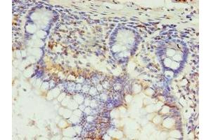 Immunohistochemistry of paraffin-embedded human small intestine tissue using ABIN7164533 at dilution of 1:100 (Senataxin (SETX) (AA 2401-2677) anticorps)
