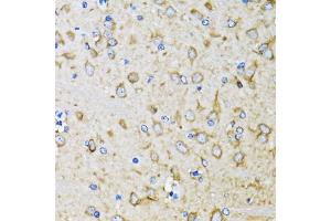 Immunohistochemistry of paraffin-embedded mouse brain using MAP1LC3B antibody (ABIN5974331) at dilution of 1/100 (40x lens). (LC3B anticorps)
