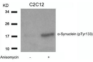 Western blot analysis of extracts from C2C12 cells untreated or treated with Anisomycin using a-Synuclein(Phospho-Tyr133) Antibody. (SNCA anticorps  (pTyr133))