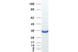 Validation with Western Blot