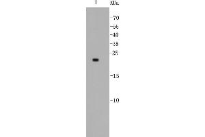 Lane 1: MCF-7 lysates probed with Bad (5D4) Monoclonal Antibody  at 1:500. (BAD anticorps)