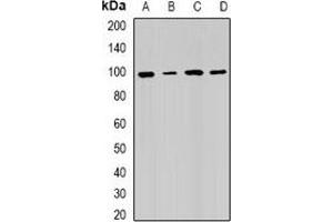 Western blot analysis of RRM1 expression in Hela (A), SW480 (B), mouse testis (C), mouse spleen (D) whole cell lysates. (RRM1 anticorps)