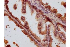 IHC image of ABIN7144227 diluted at 1:500 and staining in paraffin-embedded human prostate tissue performed on a Leica BondTM system. (ANKRD42 anticorps  (AA 158-377))