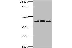 Western blot All lanes: Nucleolysin TIA-1 isoform p40 antibody at 2 μg/mL Lane 1: Jurkat whole cell lysate Lane 2: K562 whole cell lysate Lane 3: Hela whole cell lysate Secondary Goat polyclonal to rabbit IgG at 1/10000 dilution Predicted band size: 43, 42, 25 kDa Observed band size: 43 kDa (TIA1 anticorps  (AA 1-193))