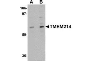 Western blot analysis of TMEM214 in A20 cell lysate with this product at (A) 1 and (B) 2 μg/ml. (TMEM214 anticorps  (N-Term))
