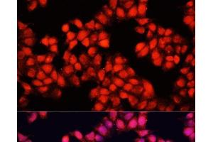 Immunofluorescence analysis of HeLa cells using ALAD Polyclonal Antibody at dilution of 1:100. (ALAD anticorps)