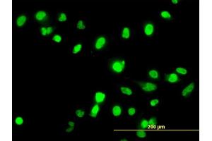 Immunofluorescence of monoclonal antibody to FANCG on HeLa cell. (FANCG anticorps  (AA 1-622))