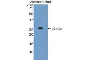 Detection of Recombinant LILRB3, Mouse using Polyclonal Antibody to Leukocyte Immunoglobulin Like Receptor Subfamily B, Member 3 (LILRB3) (LILRB3 anticorps  (AA 410-631))