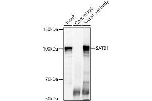 Immunoprecipitation analysis of 300 μg extracts of Jurkat cells using 3 μg S antibody (ABIN6130296, ABIN6147396, ABIN6147398 and ABIN6221485).