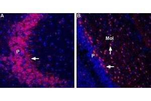 Expression of GluR7 in mouse hippocampus and rat cerebellum - Immunohistochemical staining of immersion-fixed, free floating frozen brain sections using Anti-GRIK3 (GluK3) (extracellular) Antibody (ABIN7043239, ABIN7044378 and ABIN7044379), (1:400).