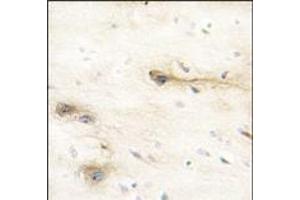 Formalin-fixed and paraffin-embedded human brain tissue reacted with MARK1 Antibody (N-term), which was peroxidase-conjugated to the secondary antibody, followed by DAB staining. (MARK1 anticorps  (N-Term))