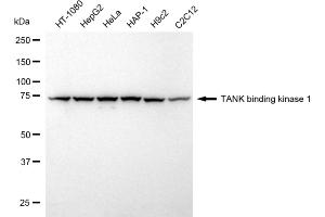 Western blotting analysis using TANK binding kinase 1 antibody (ABIN7800507). (Recombinant TBK1 anticorps)