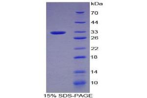 SDS-PAGE (SDS) image for Plasminogen (PLG) (AA 100-352) protein (His tag) (ABIN2121900)