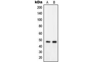 Western blot analysis of GPRIN2 expression in MDAMB435 (A), K562 (B) whole cell lysates. (GPRIN2 anticorps  (N-Term))