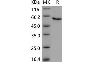Western Blotting (WB) image for serpin Peptidase Inhibitor, Clade B (Ovalbumin), Member 12 (SERPINB12) protein (His tag) (ABIN7320232)