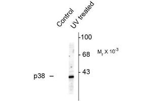 Image no. 1 for anti-Mitogen-Activated Protein Kinase 14 (MAPK14) (pThr180), (pTyr182) antibody (ABIN372694) (MAPK14 anticorps  (pThr180, pTyr182))