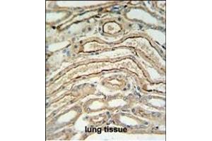 ADH7 Antibody (C-Term) (ABIN653658 and ABIN2842998) IHC analysis in formalin fixed and paraffin embedded lung tissue followed by peroxidase conjugation of the secondary antibody and DAB staining.