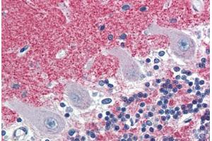 anti-Septin 5 (SEPT5) antibody