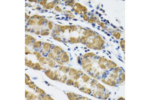 Immunohistochemistry of paraffin-embedded human stomach using HAPLN1 antibody (ABIN5973979) at dilution of 1/100 (40x lens). (HAPLN1 anticorps)